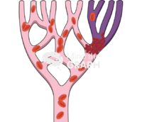 Thrombus position and consequences 2 - Edit and Customize Icons of Thrombus position and consequences 2 Thrombus position and consequences 2 Icons, Symbols, Pictures, and Images