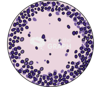 Tissue histology granuloma zoom - Edit and Customize Icons of Tissue histology granuloma zoom Tissue histology granuloma zoom Icons, Symbols, Pictures, and Images