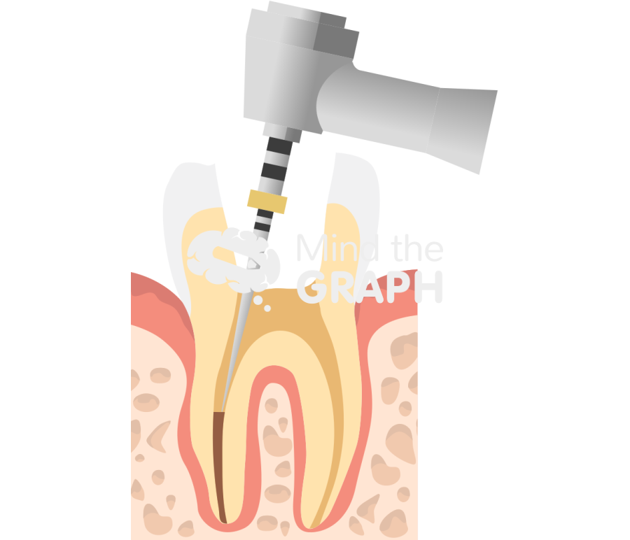Tooth treatment root canal 3 Icons, Symbols, Pictures, and Images