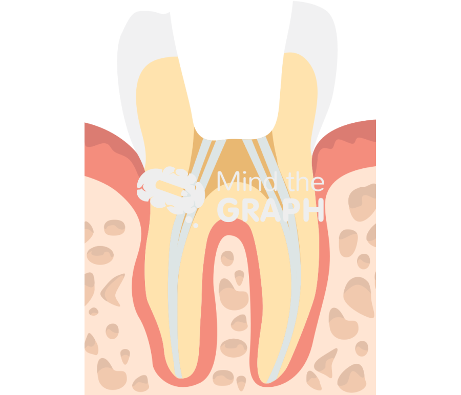 Tooth treatment root canal 7 Icons, Symbols, Pictures, and Images