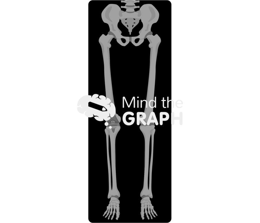 Total knee arthroplasty alignment x ray