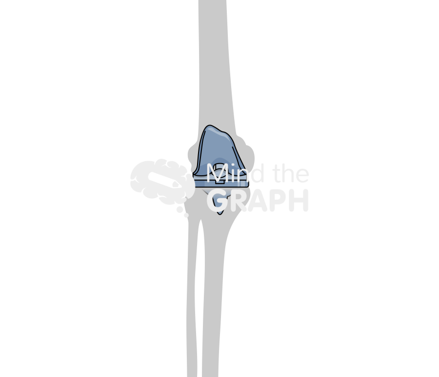 Total knee arthroplasty bone Icons, Symbols, Pictures, and Images