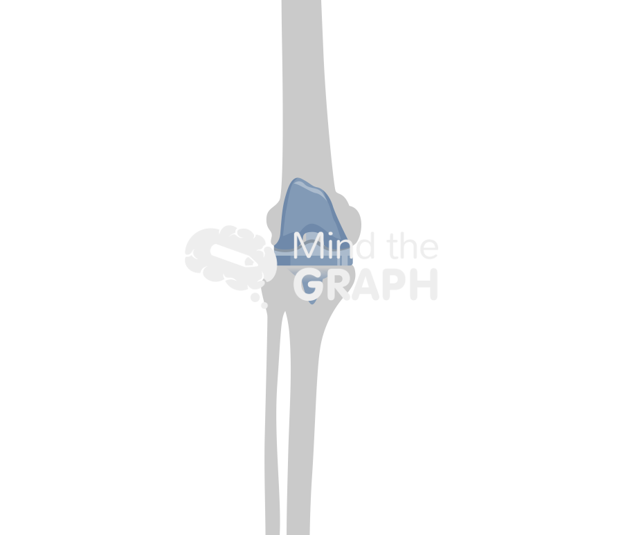 Total knee arthroplasty bone Icons, Symbols, Pictures, and Images