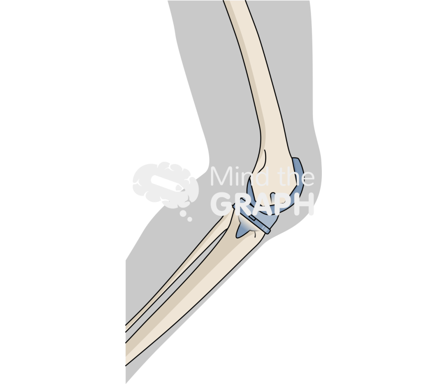 Total knee arthroplasty cruciate retaining body Icons, Symbols, Pictures, and Images
