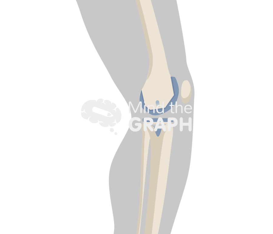 Total knee arthroplasty flexion angle body Icons, Symbols, Pictures, and Images