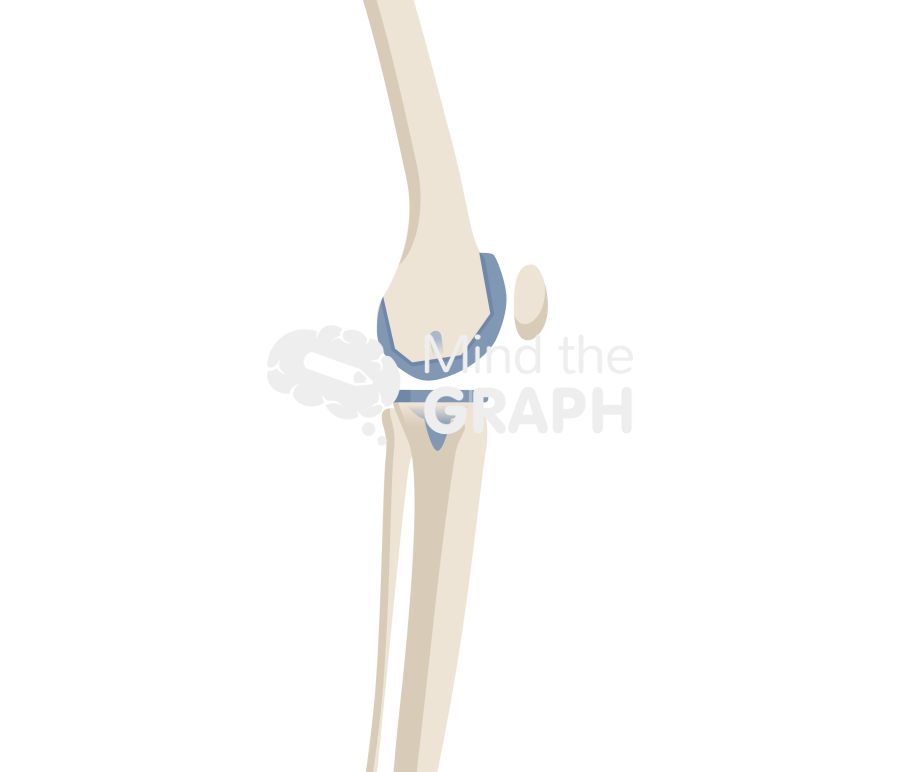 Total knee arthroplasty flexion angle bone full Icons, Symbols, Pictures, and Images