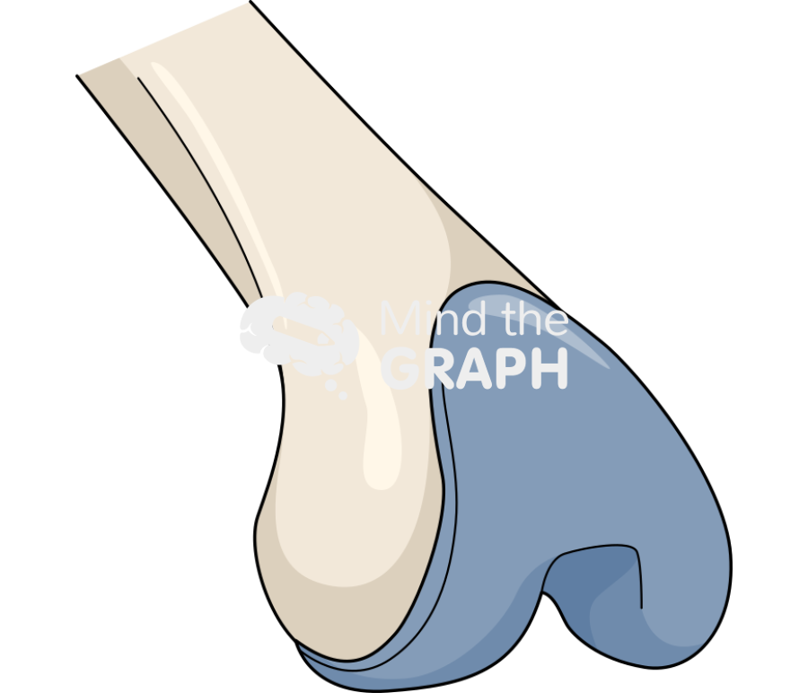 Total knee replacement 1 Icons, Symbols, Pictures, and Images