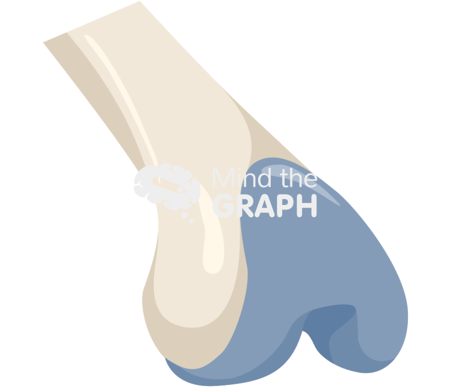 Total knee replacement 1 Icons, Symbols, Pictures, and Images