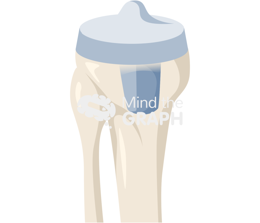 Total knee replacement 2 Icons, Symbols, Pictures, and Images