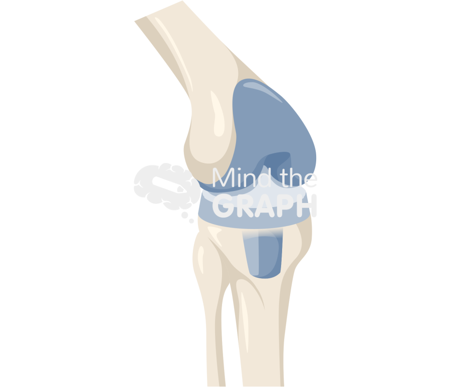 Total knee replacement bone full Icons, Symbols, Pictures, and Images