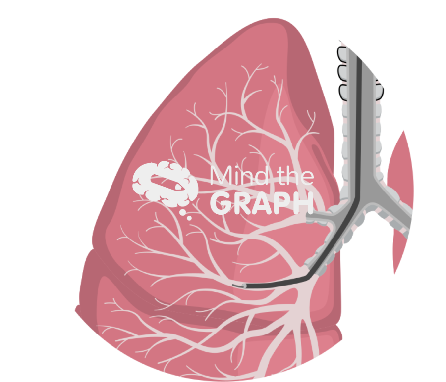 Transbronchial injection zoom Icons, Symbols, Pictures, and Images