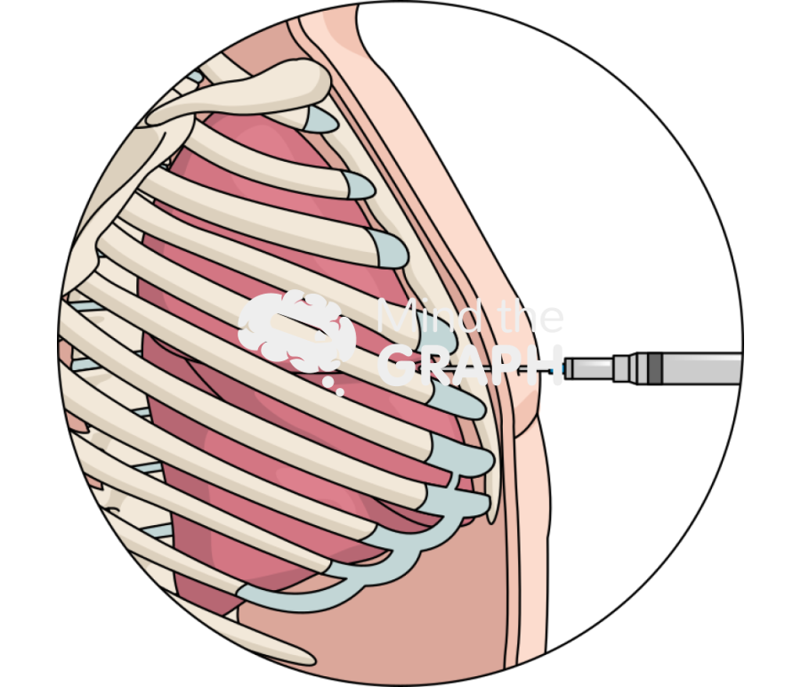 Transcutaneous injection zoom Icons, Symbols, Pictures, and Images