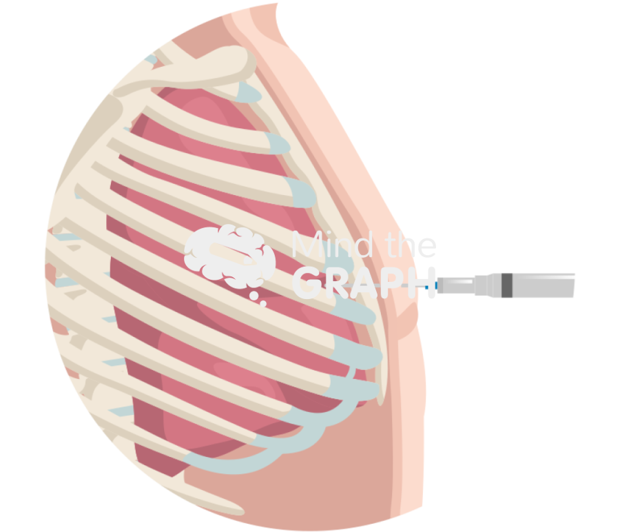 Transcutaneous injection zoom Icons, Symbols, Pictures, and Images