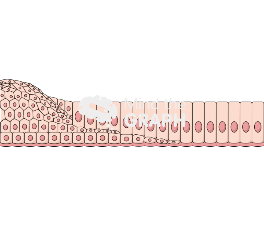 Transition squamous epithelial cells columnar epithelial cells Icons, Symbols, Pictures, and Images