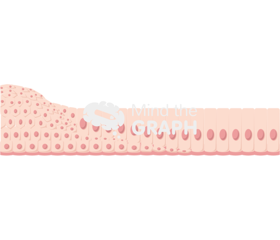 Transition squamous epithelial cells columnar epithelial cells Icons, Symbols, Pictures, and Images