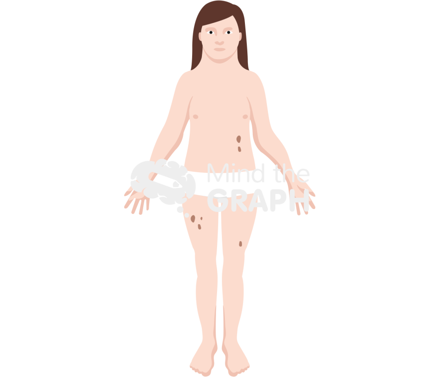 Turner syndrome Icons, Symbols, Pictures, and Images