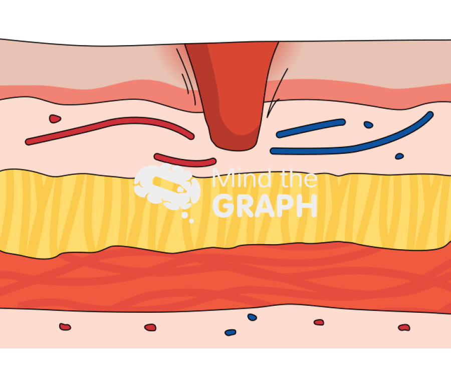 Ulcer gastric mucosal epithelial tissue Icons, Symbols, Pictures, and Images
