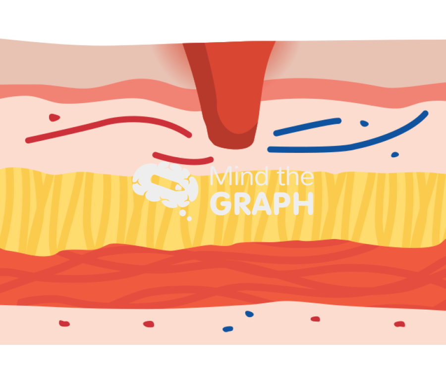 Ulcer gastric mucosal epithelial tissue Icons, Symbols, Pictures, and Images
