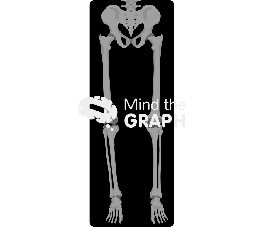 Unicompartment knee arthroplasty high tibial osteotomy alignment x ray Icons, Symbols, Pictures, and Images