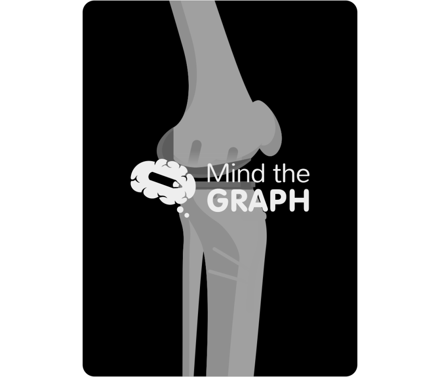 Unicompartmental knee arthroplasty high tibial osteotomy lateral x ray Icons, Symbols, Pictures, and Images