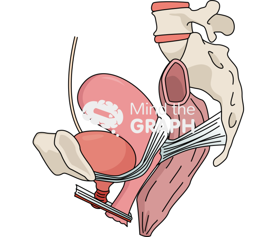 Uterine support ligaments Icons, Symbols, Pictures, and Images