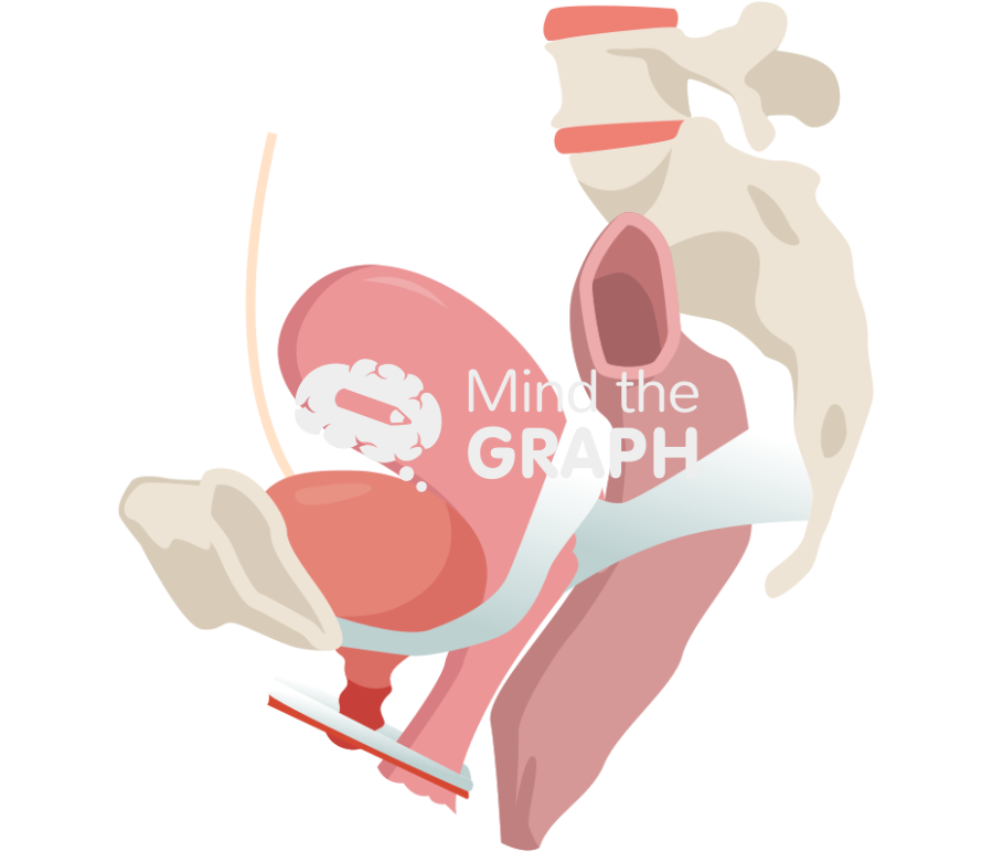 Uterine support ligaments Icons, Symbols, Pictures, and Images