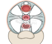 Uterine support ligaments 2 Icons, Symbols, Pictures, and Images
