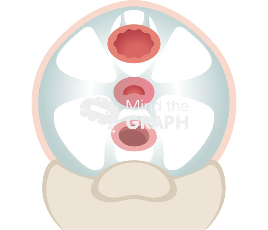 Uterine support ligaments 2 Icons, Symbols, Pictures, and Images