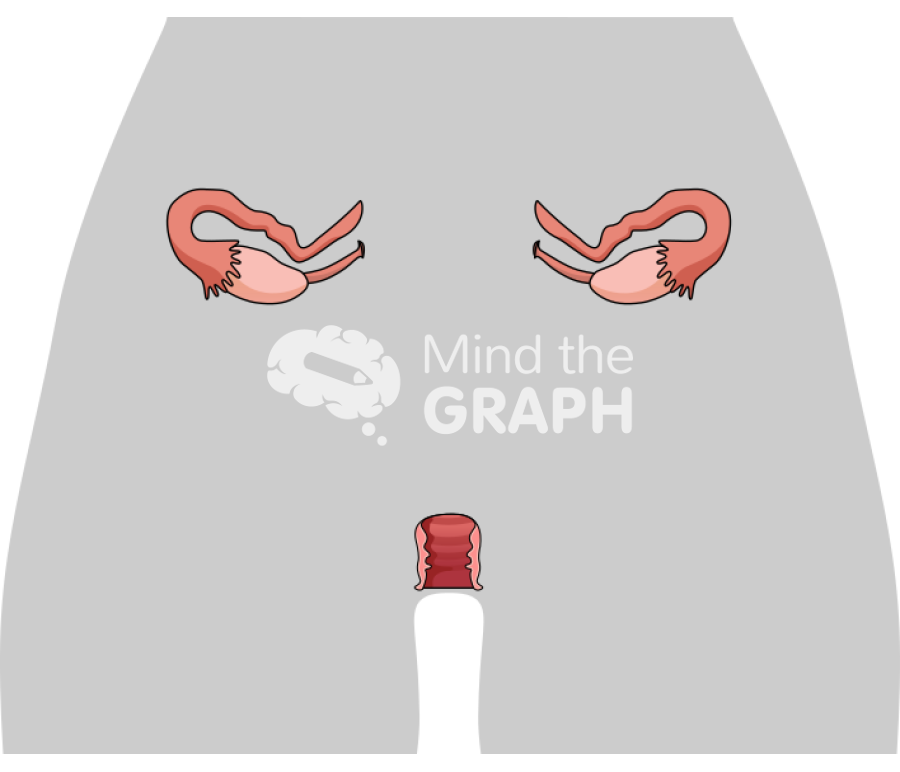 Uterus rokitansky syndrome front cut body Icons, Symbols, Pictures, and Images