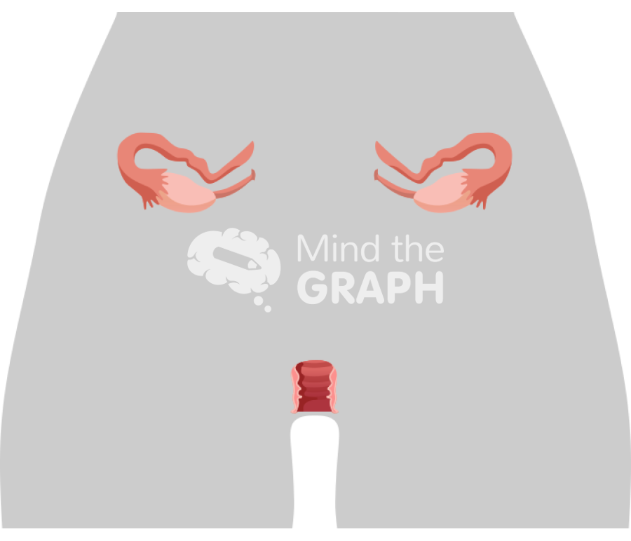 Uterus rokitansky syndrome front cut body Icons, Symbols, Pictures, and Images