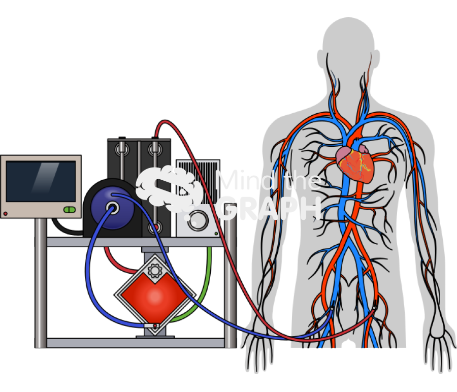 Va ecmo venoarterial extracorporeal membrane oxygenation Icons, Symbols, Pictures, and Images