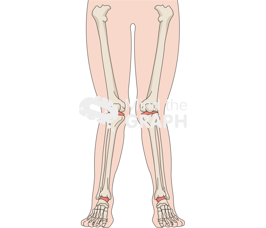 Valgus knees 2 Icons, Symbols, Pictures, and Images