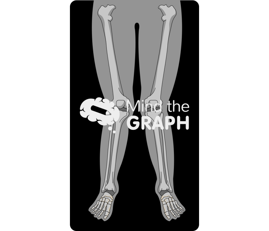 Valgus knees x ray Icons, Symbols, Pictures, and Images