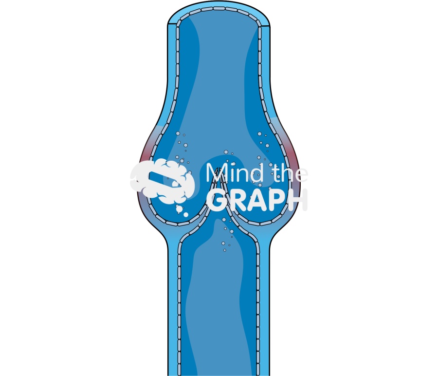 Valve at early stage of inflammation Icons, Symbols, Pictures, and Images