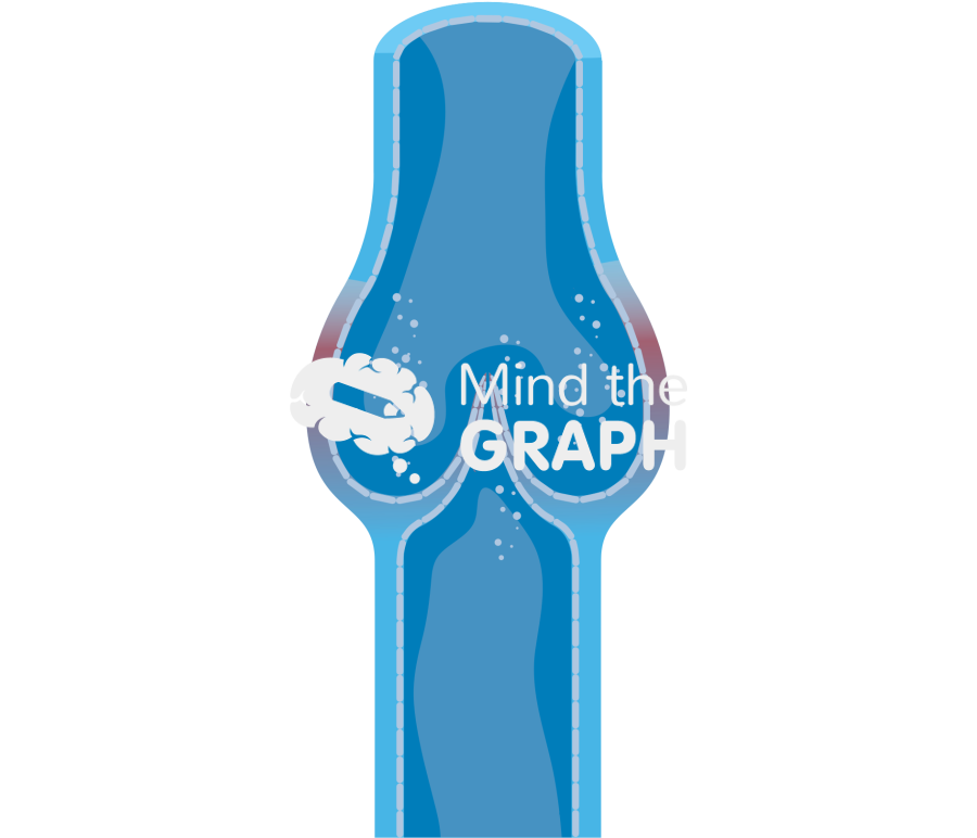 Valve at early stage of inflammation Icons, Symbols, Pictures, and Images