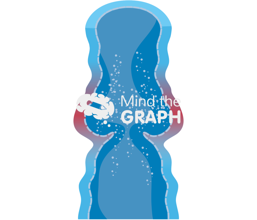 Varicose vein inflamed with incopetent valve Icons, Symbols, Pictures, and Images