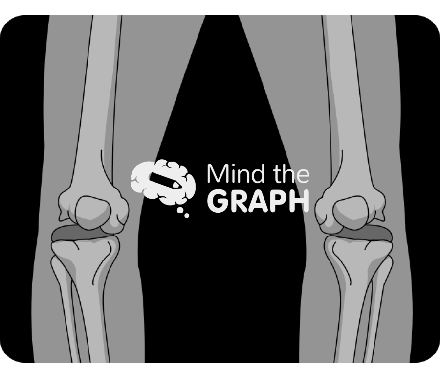 Varus knee x ray Icons, Symbols, Pictures, and Images