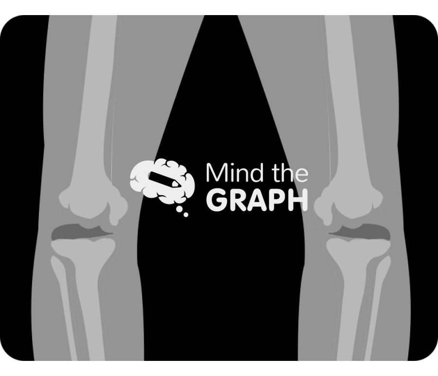 Varus knee x ray Icons, Symbols, Pictures, and Images