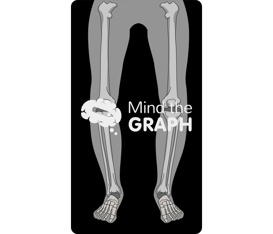 Varus knees x ray Icons, Symbols, Pictures, and Images