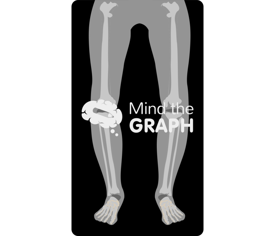 Varus knees x ray Icons, Symbols, Pictures, and Images