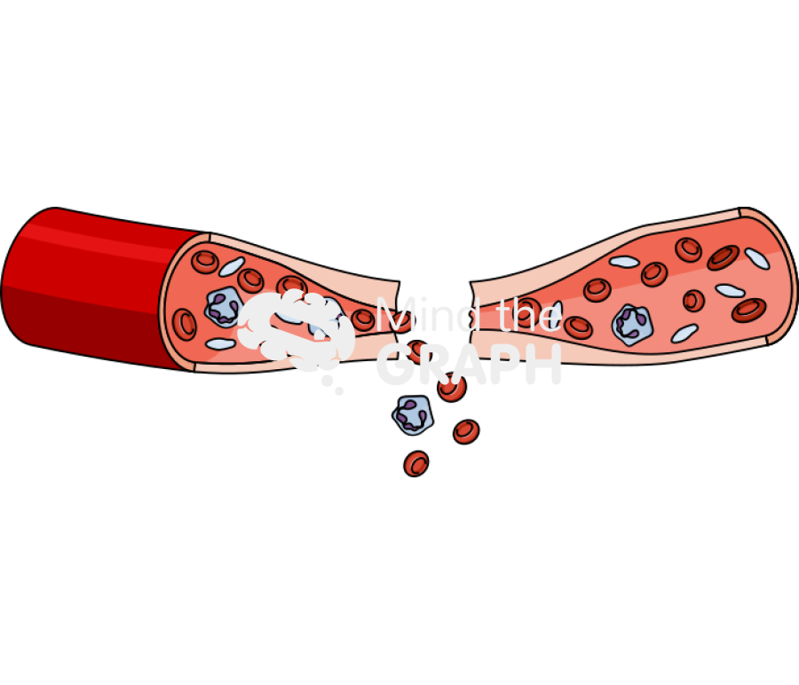 Vascular spasm blood vessel longitudinal cut Icons, Symbols, Pictures, and Images