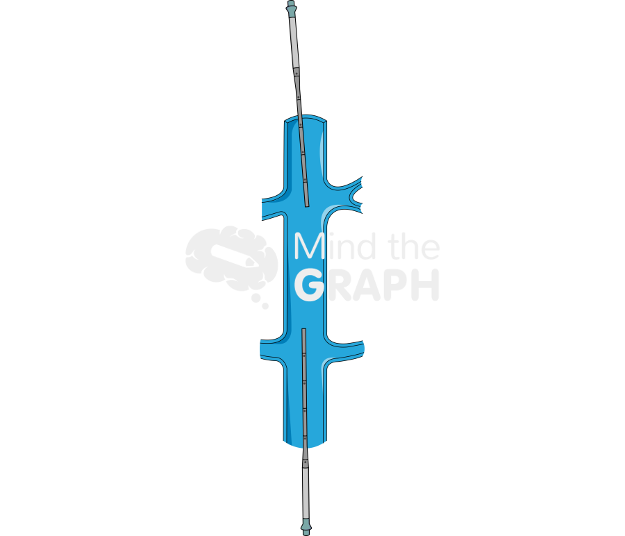 Venous arterial femoral cannula ecmo Icons, Symbols, Pictures, and Images