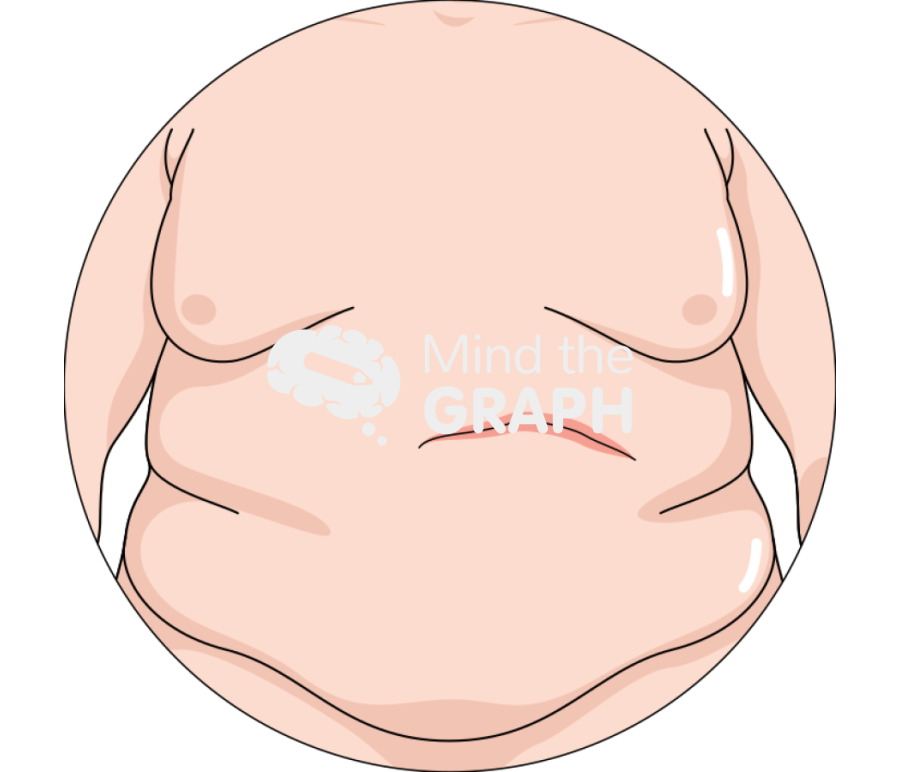 Ventral hernia free Icons, Symbols, Pictures, and Images