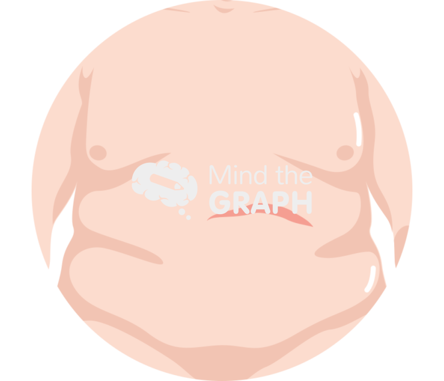 Ventral hernia free Icons, Symbols, Pictures, and Images