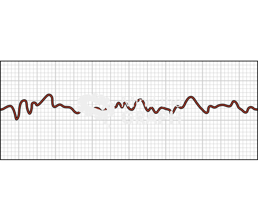 Ventricular fibrillation electrocardiogram Icons, Symbols, Pictures, and Images