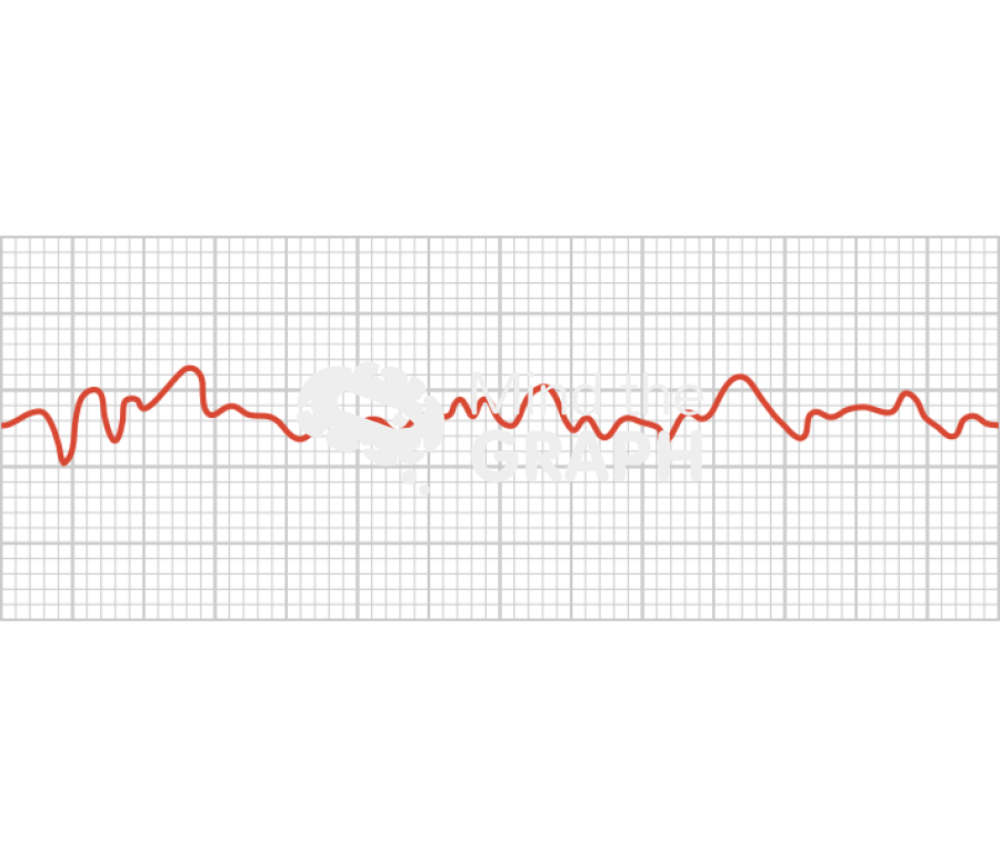 Ventricular fibrillation electrocardiogram Icons, Symbols, Pictures, and Images