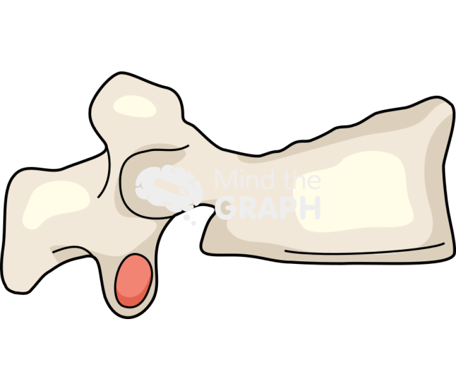 Vertebra fracture 3 Icons, Symbols, Pictures, and Images
