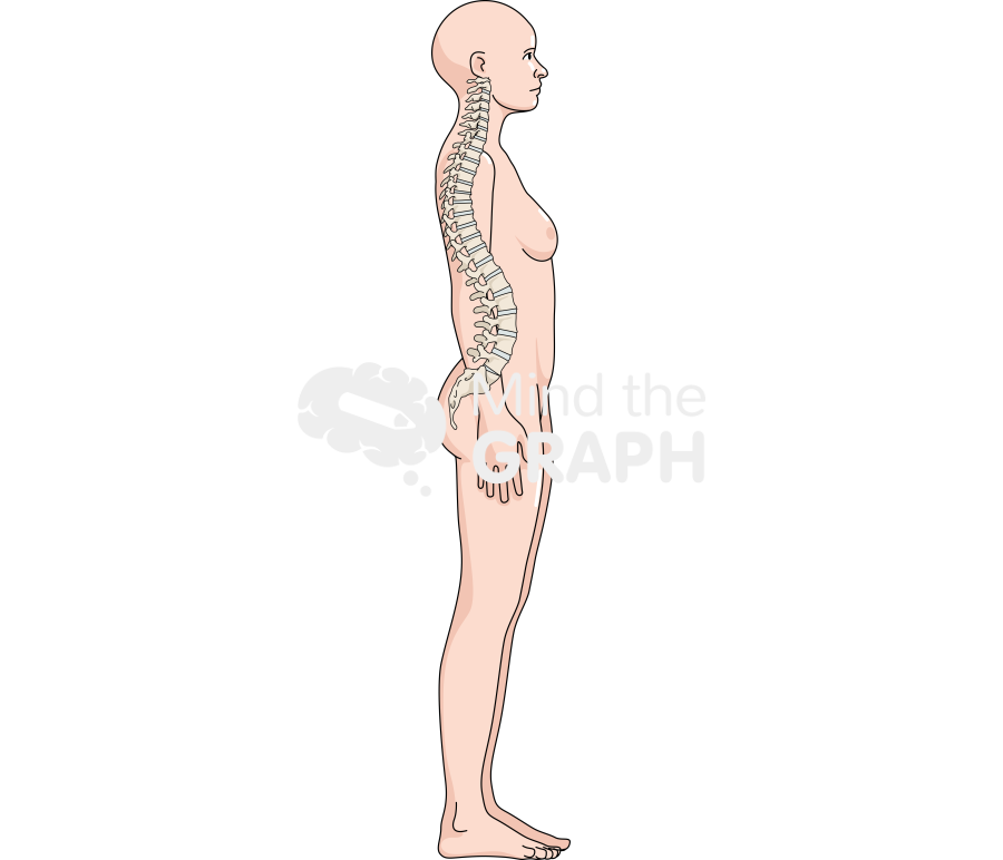 Woman column lordosis lateral body full Icons, Symbols, Pictures, and Images