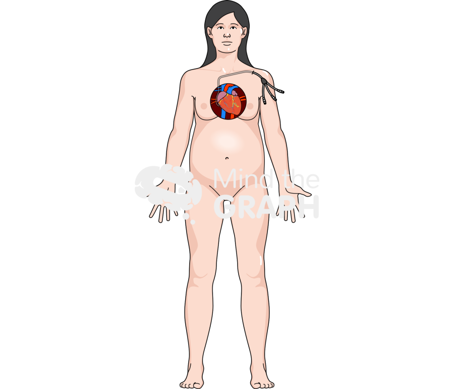 Woman pregnant monitoring heart front Icons, Symbols, Pictures, and Images