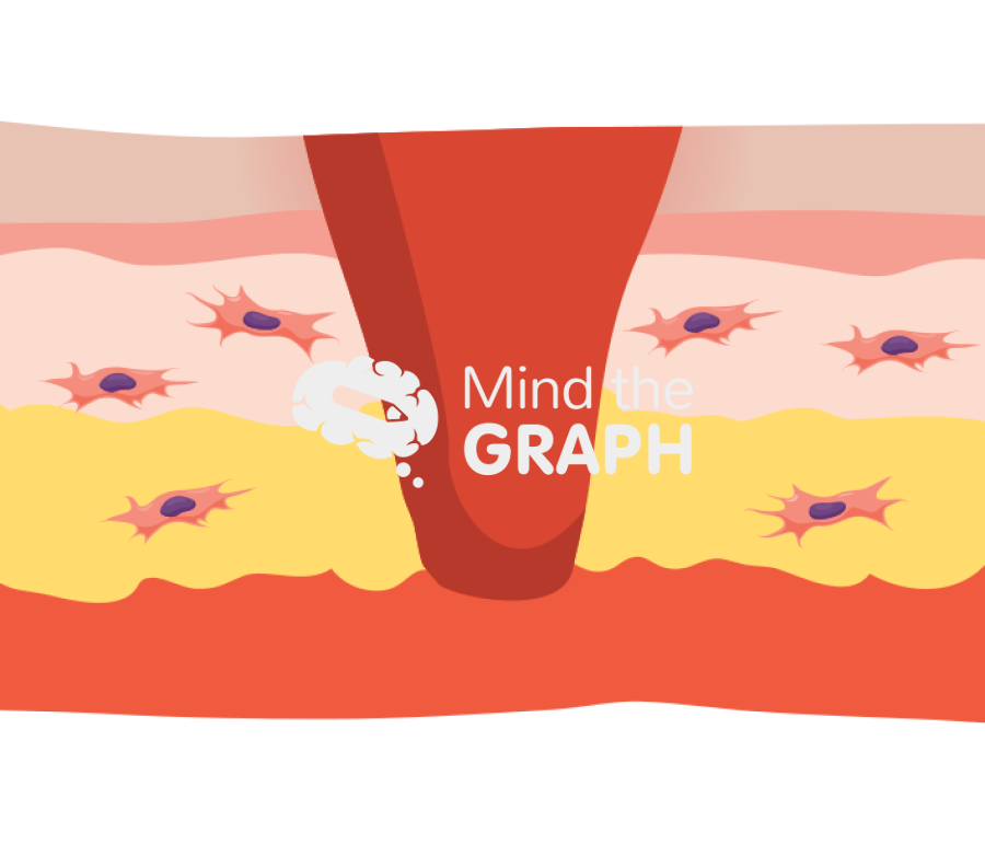Wound healing bleeding longitudinal cut Icons, Symbols, Pictures, and Images